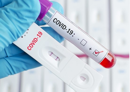 Новите случаи на коронавирус установени у нас през последното денонощие